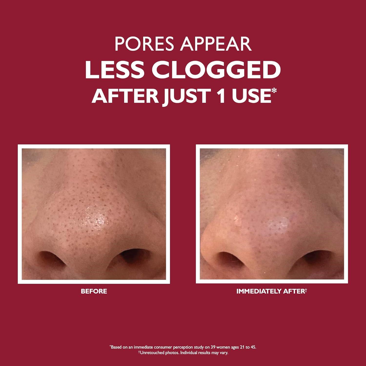 imagePeter Thomas Roth Even Smoother Microdermabrasion Exfoliating Pore Purifier