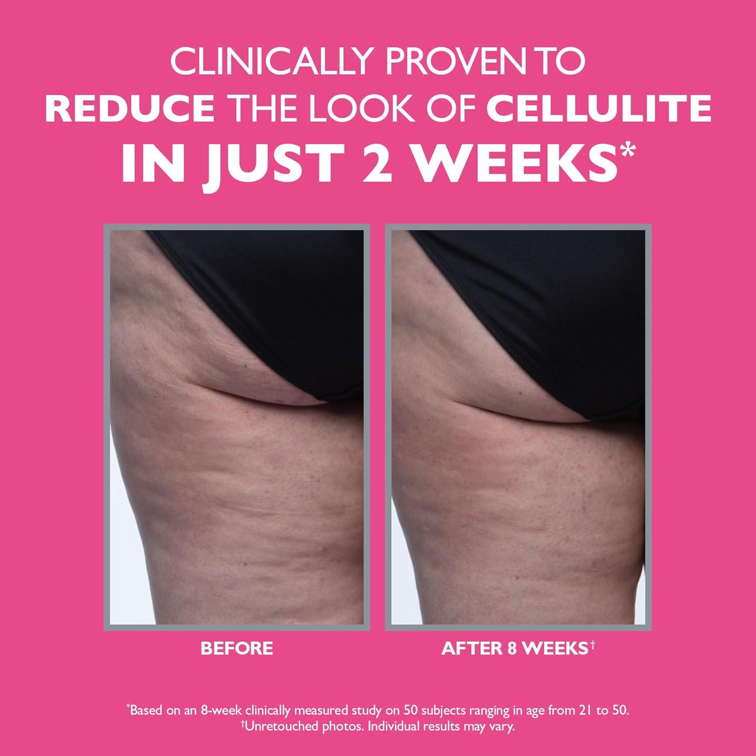 imagePeter Thomas Roth FIRMx Tight ampamp Toned Cellulite Treatment Body Cream Clinically Proven to Reduce the Look of Cellulite In Just 2 Weeks
