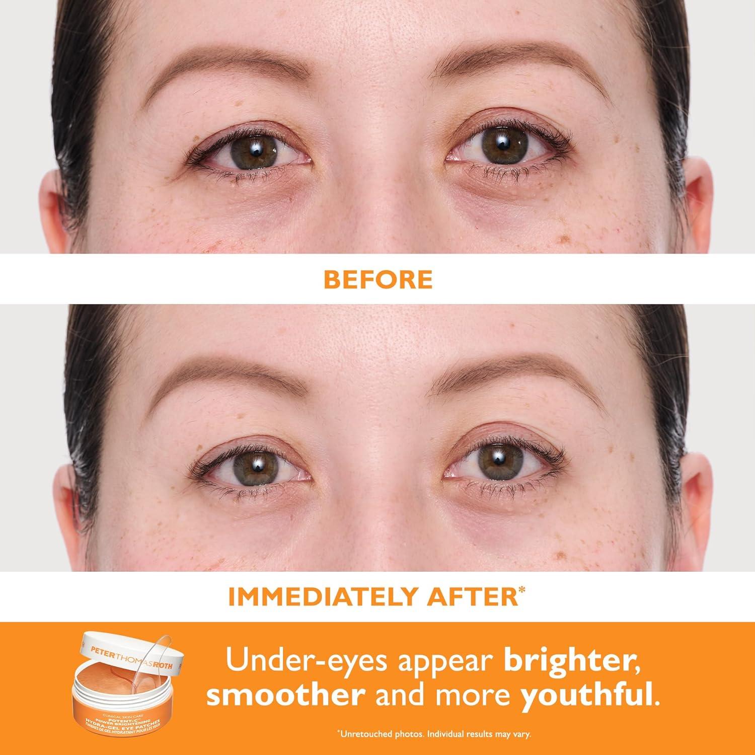 imagePeter Thomas Roth  FullSize Vitamin C ampamp Hyaluronic Eye Patches 2Piece Kit