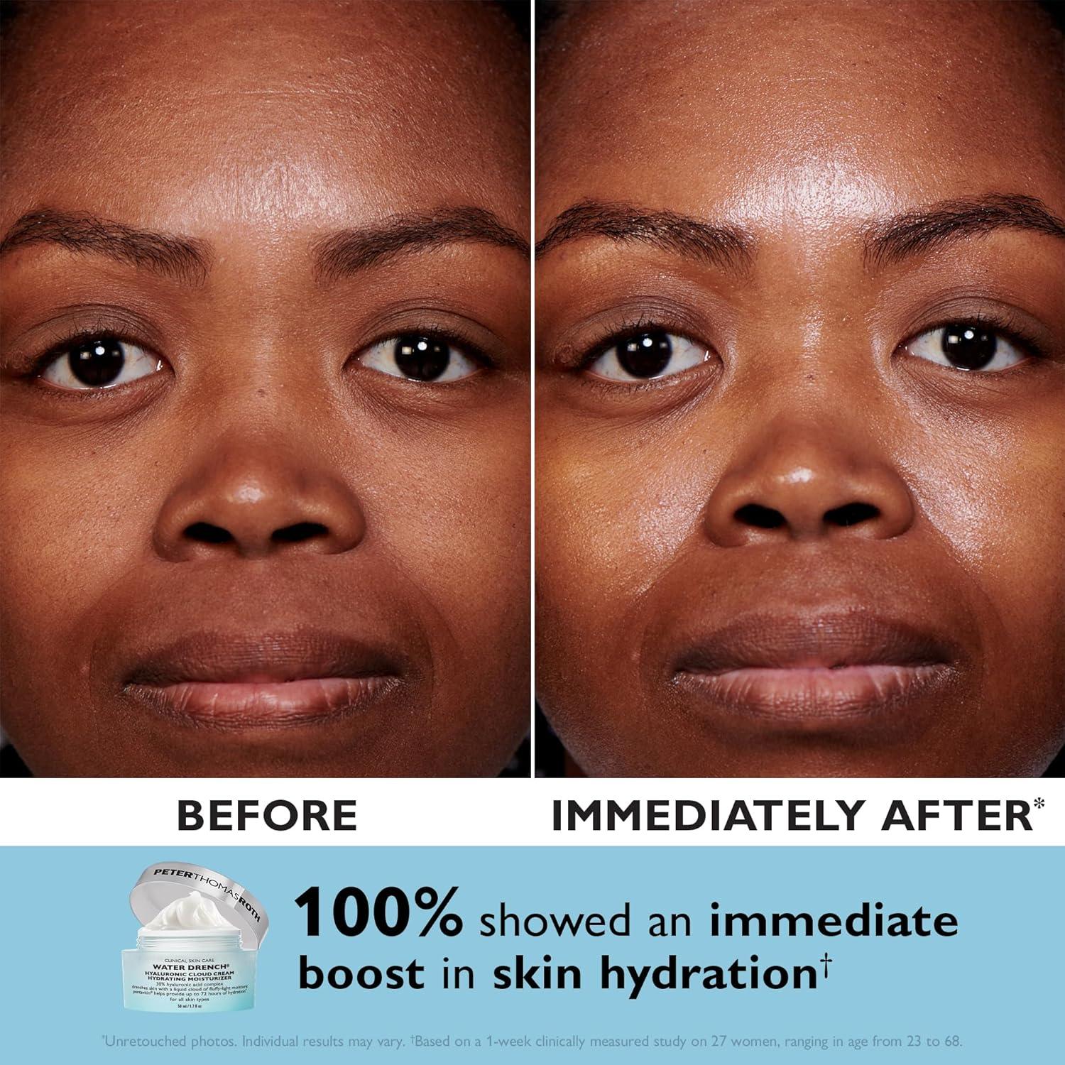 imagePeter Thomas Roth FullSize Water Drench Essentials 2Piece Face ampamp Eye Kit Hyaluronic Acid Skincare Set Moisturizer and Eye Masks